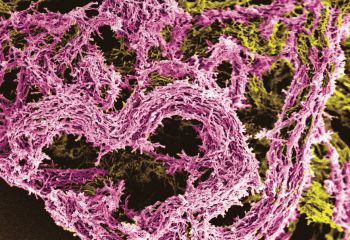 Mycobacterium bovis BCG