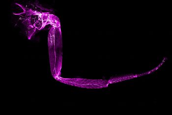 Side view of a drosophilia leg